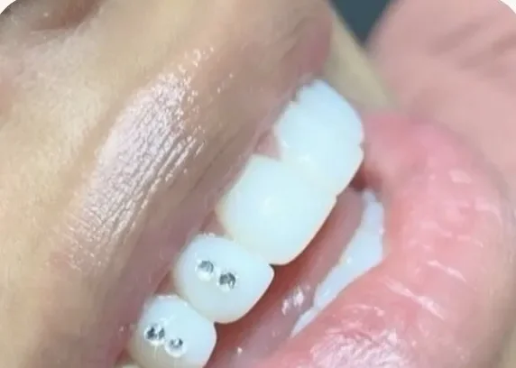 Zobu kristāli — klasiskais kristāls tuvplānā